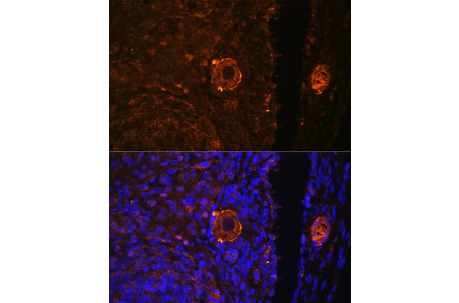 Immunofluorescence - Anti-ZP3 Antibody (A10401) - Antibodies.com