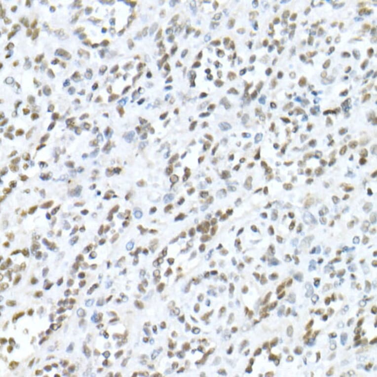 Immunohistochemistry - Anti-MDC1 Antibody (A10402) - Antibodies.com