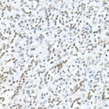 Immunohistochemistry - Anti-MDC1 Antibody (A10402) - Antibodies.com