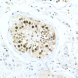 Immunohistochemistry - Anti-MDC1 Antibody (A10402) - Antibodies.com