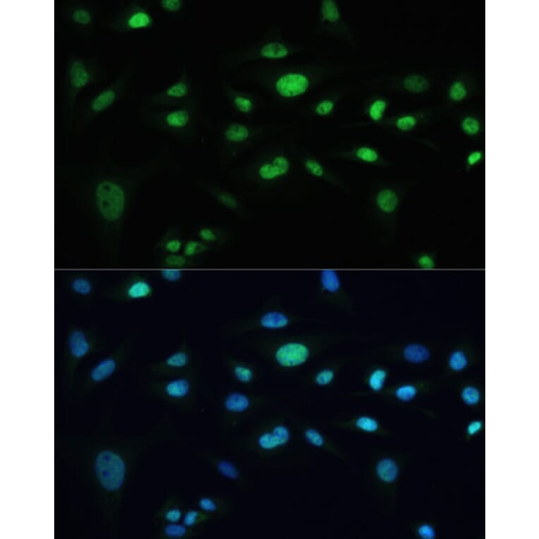 Immunofluorescence - Anti-MDC1 Antibody (A10402) - Antibodies.com