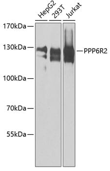 Western blot analysis of extracts of various cell lines, using Anti-PPP6R2 Antibody (A8359) at 1:1,000 dilution.
Secondary antibody: Goat Anti-Rabbit IgG (H+L) (HRP) (AS014) at 1:10,000 dilution.
Lysates / proteins: 25µg per lane.
Blocking buffer: 3% non-fat dry milk in TBST.
Detection: ECL Enhanced Kit (RM00021).
Exposure time: 10s.