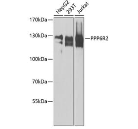 Western Blot - Anti-PPP6R2 Antibody (A8359) - Antibodies.com