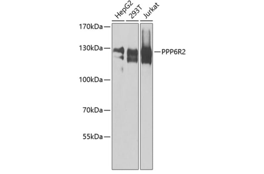 Western Blot - Anti-PPP6R2 Antibody (A8359) - Antibodies.com