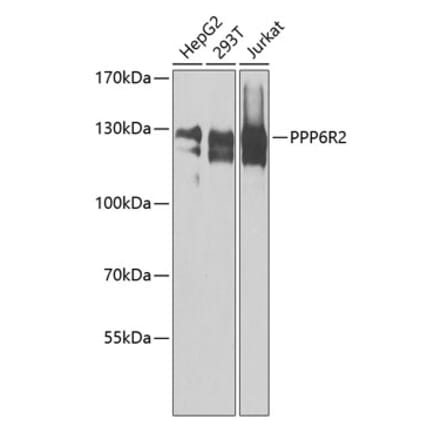 Western Blot - Anti-PPP6R2 Antibody (A8359) - Antibodies.com