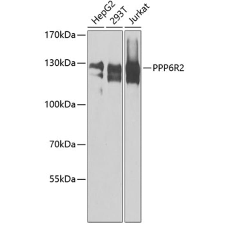 Western Blot - Anti-PPP6R2 Antibody (A8359) - Antibodies.com