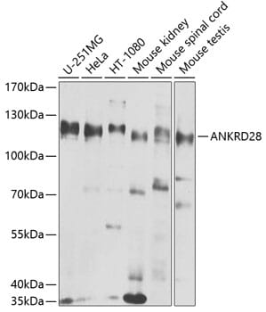Western blot analysis of extracts of various cell lines, using Anti-ANKRD28 Antibody (A8365) at 1:1,000 dilution.
Secondary antibody: Goat Anti-Rabbit IgG (H+L) (HRP) (AS014) at 1:10,000 dilution.
Lysates / proteins: 25µg per lane.
Blocking buffer: 3% non-fat dry milk in TBST.
Detection: ECL Basic Kit (RM00020).
Exposure time: 30s.