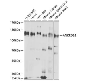 Western Blot - Anti-ANKRD28 Antibody (A10405) - Antibodies.com