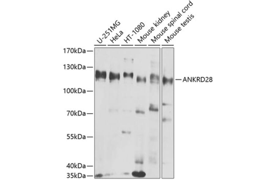 Western Blot - Anti-ANKRD28 Antibody (A10405) - Antibodies.com