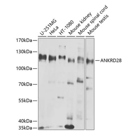 Western Blot - Anti-ANKRD28 Antibody (A10405) - Antibodies.com