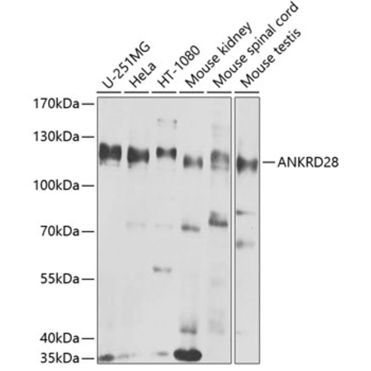 Western Blot - Anti-ANKRD28 Antibody (A10405) - Antibodies.com