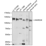 Western Blot - Anti-ANKRD28 Antibody (A10405) - Antibodies.com