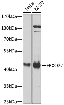 Western blot analysis of extracts of various cell lines, using Anti-FBXO22 Antibody (A8367) at 1:1,000 dilution.
Secondary antibody: Goat Anti-Rabbit IgG (H+L) (HRP) (AS014) at 1:10,000 dilution.
Lysates / proteins: 25µg per lane.
Blocking buffer: 3% non-fat dry milk in TBST.
Detection: ECL Basic Kit (RM00020).
Exposure time: 5s.