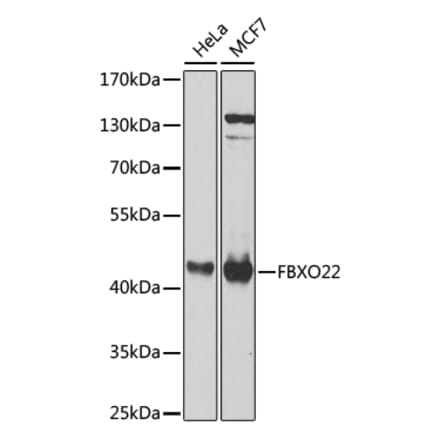 Western Blot - Anti-FBXO22 Antibody (A10406) - Antibodies.com