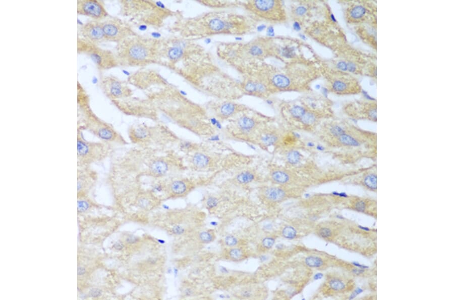 Immunohistochemistry - Anti-NUDT15 Antibody (A10407) - Antibodies.com