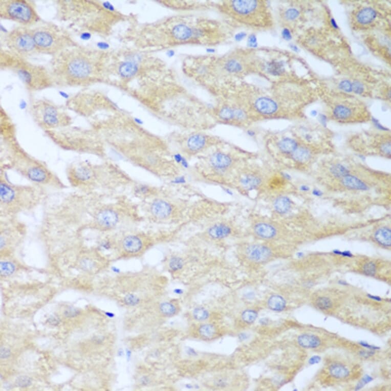Immunohistochemistry - Anti-NUDT15 Antibody (A10407) - Antibodies.com