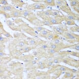 Immunohistochemistry - Anti-NUDT15 Antibody (A10407) - Antibodies.com