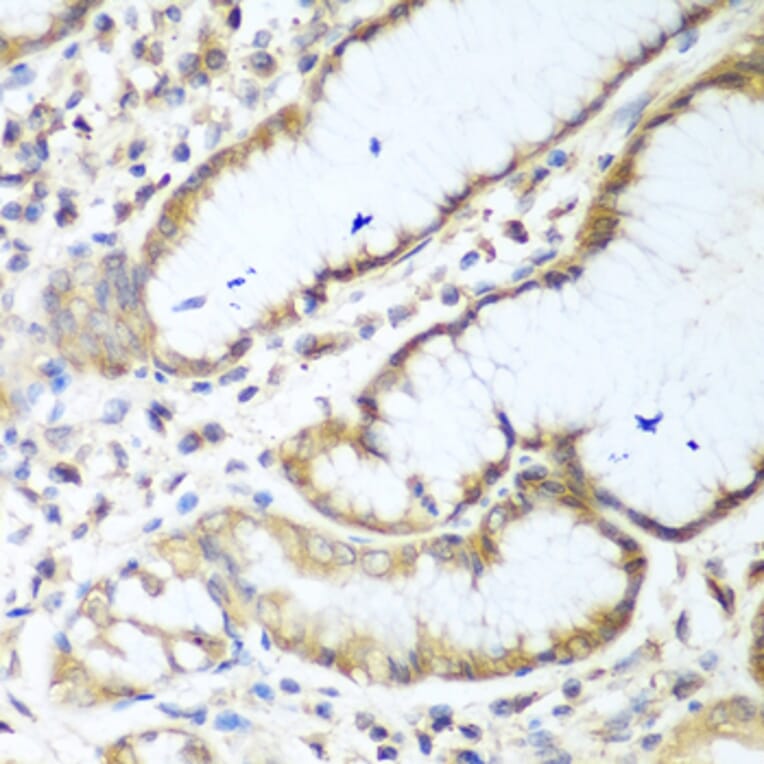 Immunohistochemistry - Anti-NUDT15 Antibody (A10407) - Antibodies.com