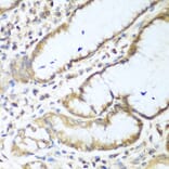 Immunohistochemistry - Anti-NUDT15 Antibody (A10407) - Antibodies.com