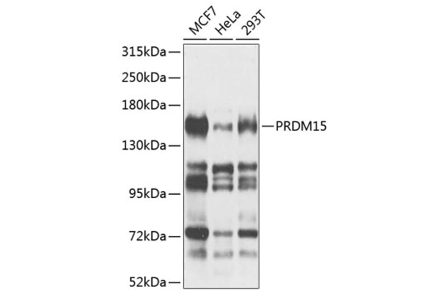 Western Blot - Anti-PRDM15 Antibody (A8371) - Antibodies.com