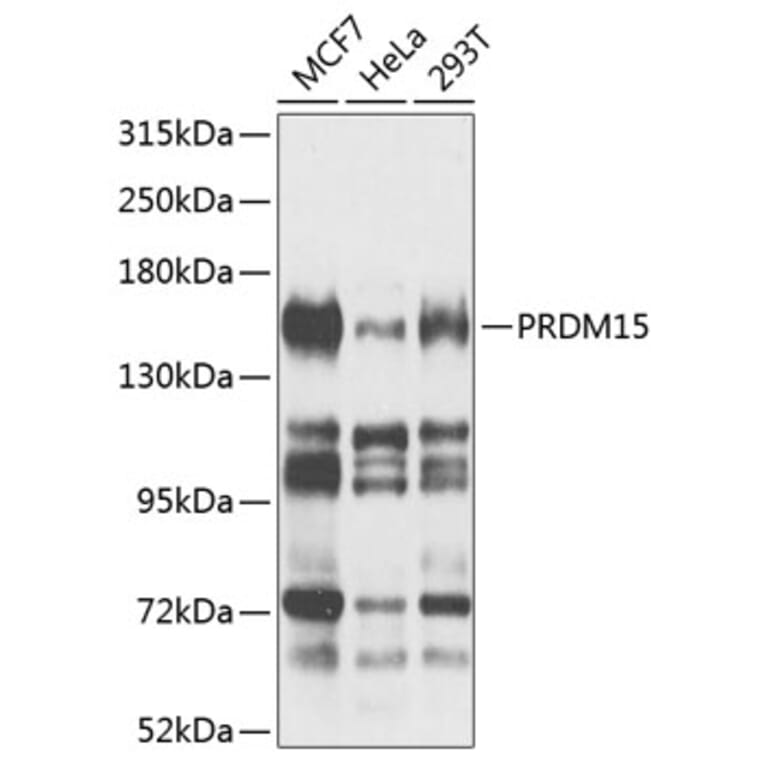 Western Blot - Anti-PRDM15 Antibody (A8371) - Antibodies.com