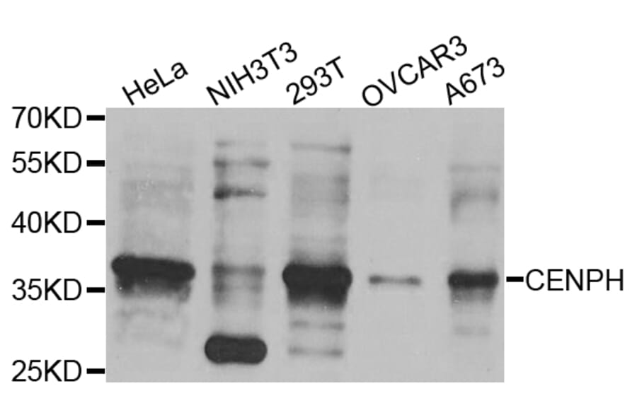 Western Blot - Anti-CENPH Antibody (A8372) - Antibodies.com