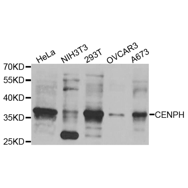 Western Blot - Anti-CENPH Antibody (A8372) - Antibodies.com