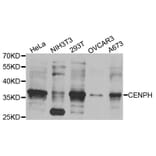 Western Blot - Anti-CENPH Antibody (A8372) - Antibodies.com