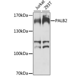 Western Blot - Anti-PALB2 Antibody (A10410) - Antibodies.com