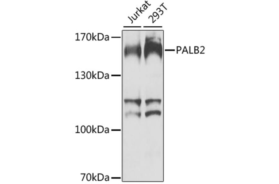 Western Blot - Anti-PALB2 Antibody (A10410) - Antibodies.com