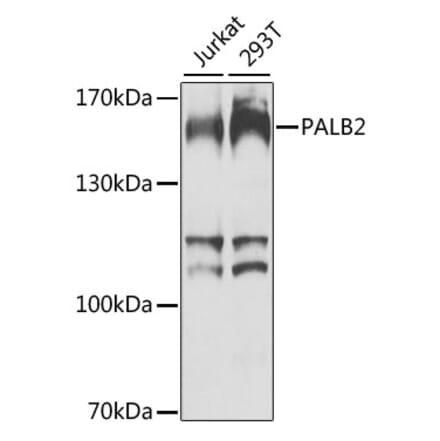 Western Blot - Anti-PALB2 Antibody (A10410) - Antibodies.com