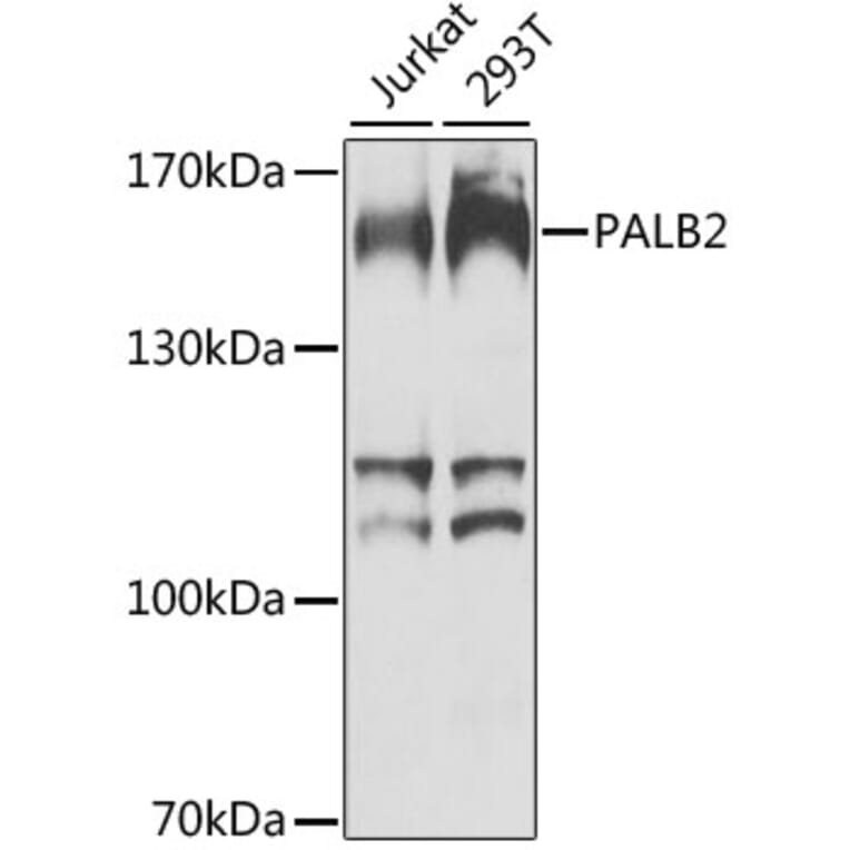 Western Blot - Anti-PALB2 Antibody (A10410) - Antibodies.com