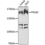 Western Blot - Anti-PALB2 Antibody (A10410) - Antibodies.com