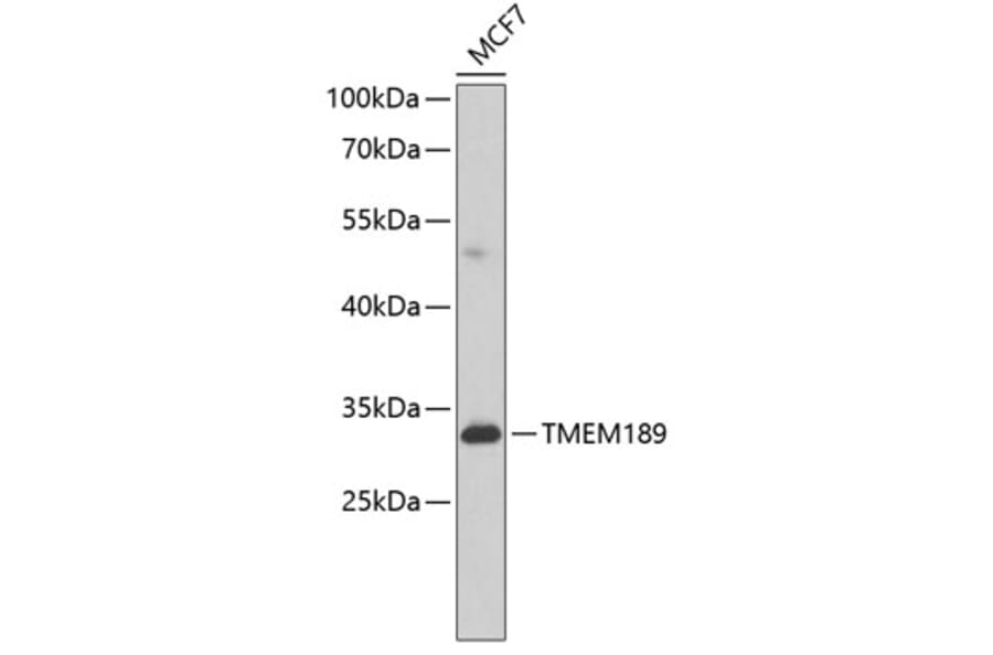 Western Blot - Anti-PEDS1 Antibody (A10411) - Antibodies.com