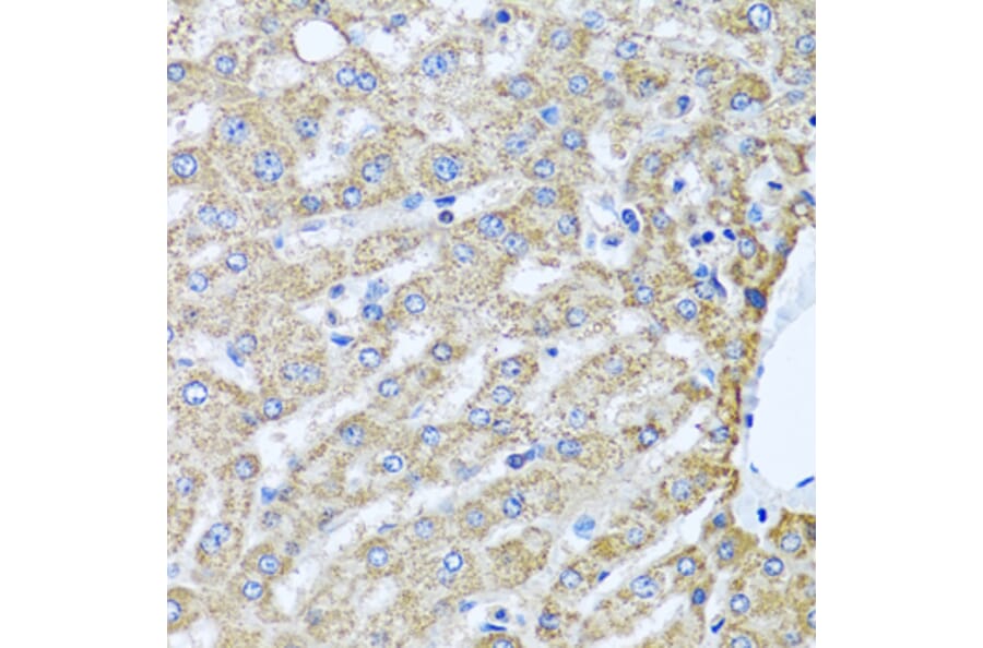 Immunohistochemistry - Anti-PEDS1 Antibody (A10411) - Antibodies.com