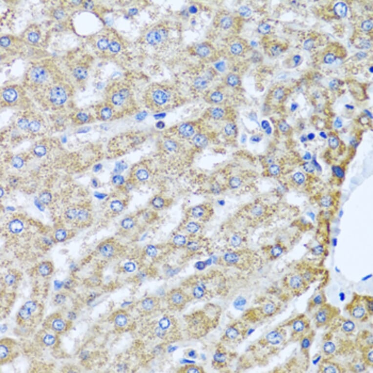 Immunohistochemistry - Anti-PEDS1 Antibody (A10411) - Antibodies.com
