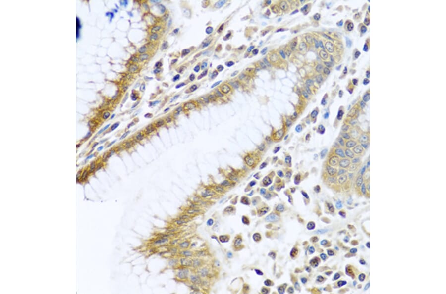 Immunohistochemistry - Anti-PEDS1 Antibody (A10411) - Antibodies.com