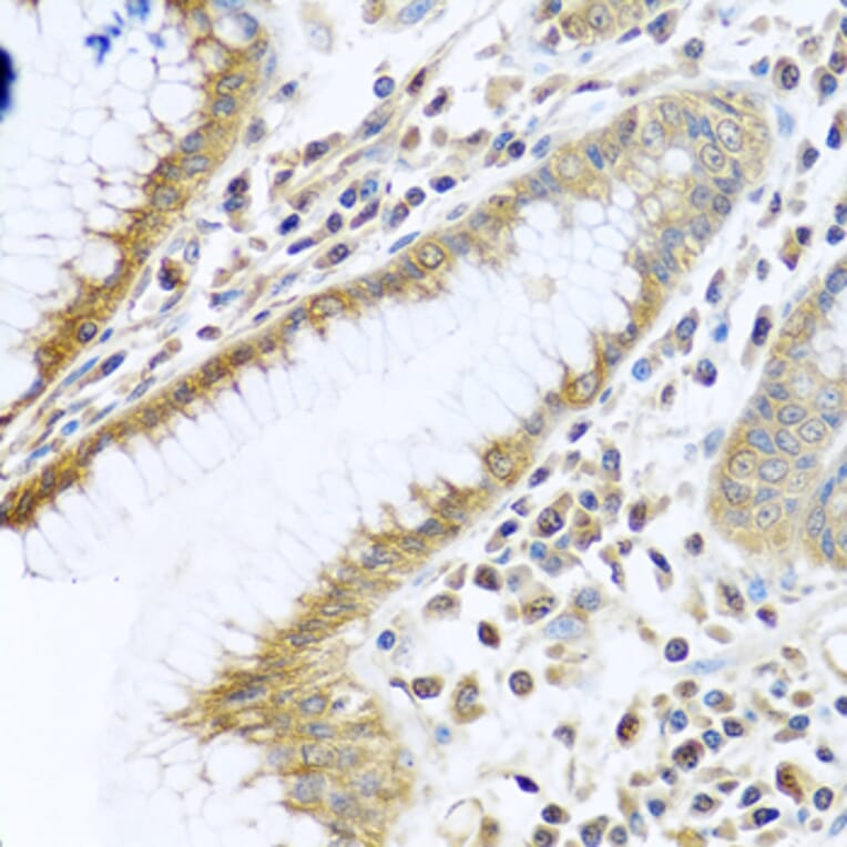 Immunohistochemistry - Anti-PEDS1 Antibody (A10411) - Antibodies.com