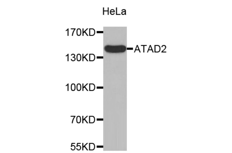 Western Blot - Anti-ATAD2 Antibody (A8382) - Antibodies.com