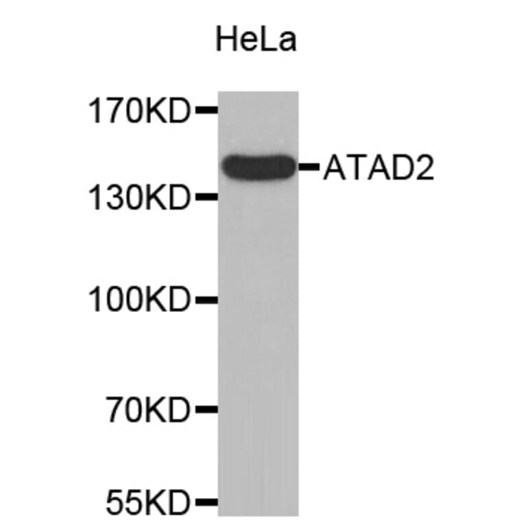 Western Blot - Anti-ATAD2 Antibody (A8382) - Antibodies.com