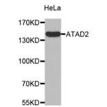 Western Blot - Anti-ATAD2 Antibody (A8382) - Antibodies.com