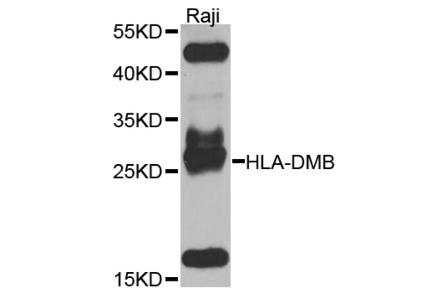 Western Blot - Anti-HLA-DMB Antibody (A8384) - Antibodies.com