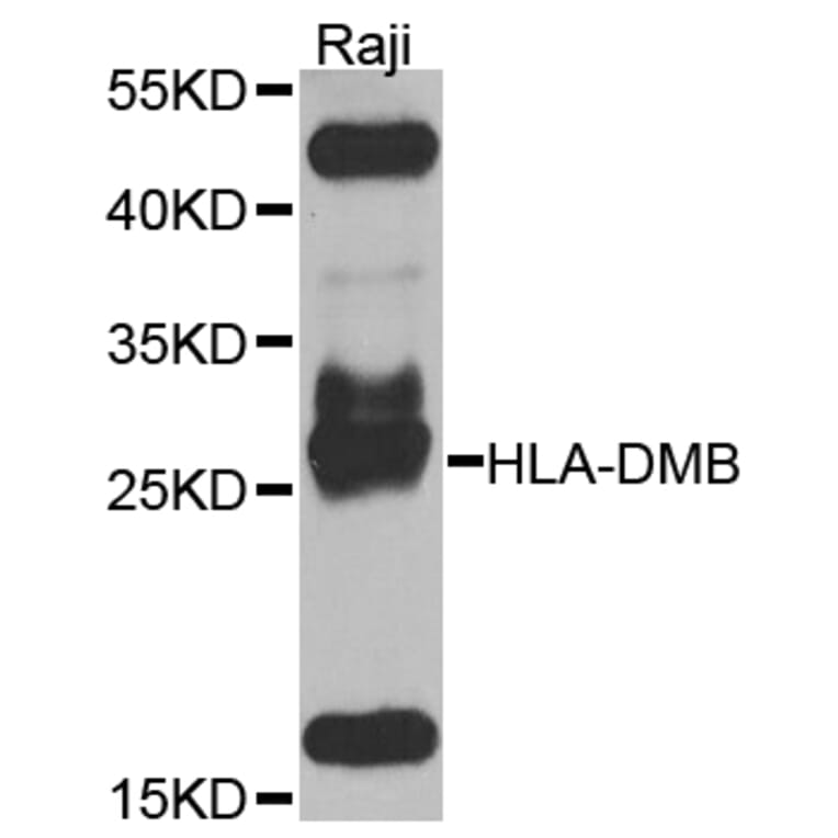 Western Blot - Anti-HLA-DMB Antibody (A8384) - Antibodies.com