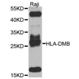 Western Blot - Anti-HLA-DMB Antibody (A8384) - Antibodies.com