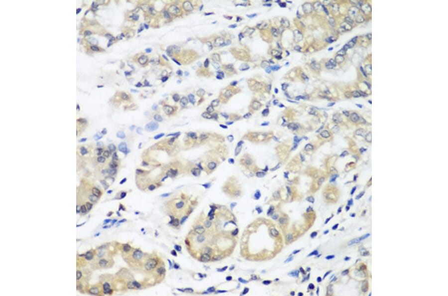 Immunohistochemistry - Anti-HLA-DMB Antibody (A8384) - Antibodies.com