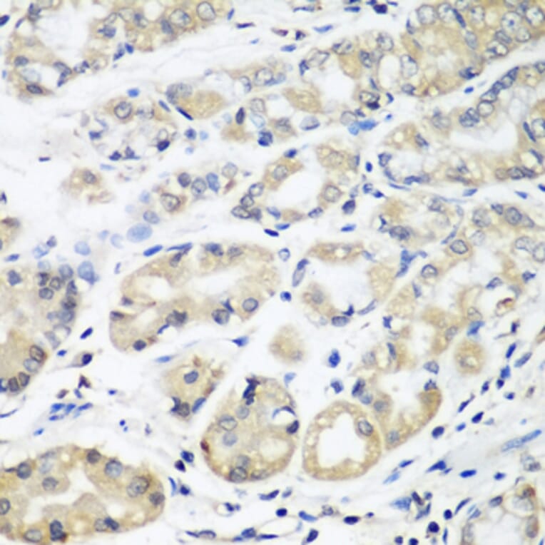 Immunohistochemistry - Anti-HLA-DMB Antibody (A8384) - Antibodies.com
