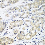 Immunohistochemistry - Anti-HLA-DMB Antibody (A8384) - Antibodies.com
