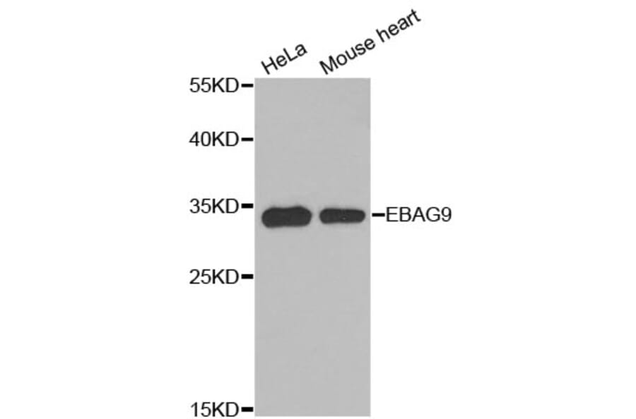 Western Blot - Anti-EBAG9 Antibody (A8385) - Antibodies.com