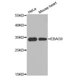 Western Blot - Anti-EBAG9 Antibody (A8385) - Antibodies.com