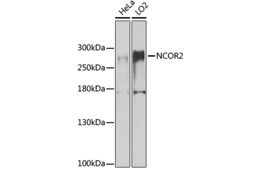 Western Blot - Anti-NCOR2/SMRT Antibody (A10415) - Antibodies.com